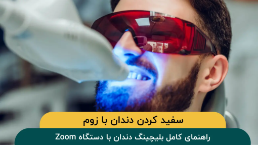 سفید-کردن-دندان-با-زوم